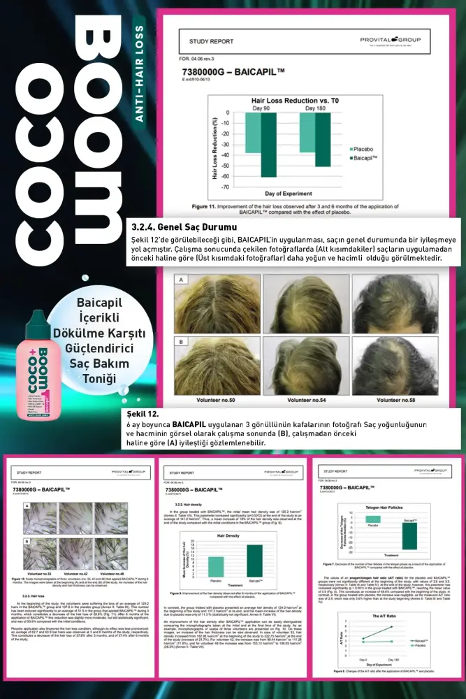 COCO BOOM Baicapil içerikli Dökülme Karşıtı Güçlendirici Saç Bakım Boomu 120 ML - Thumbnail