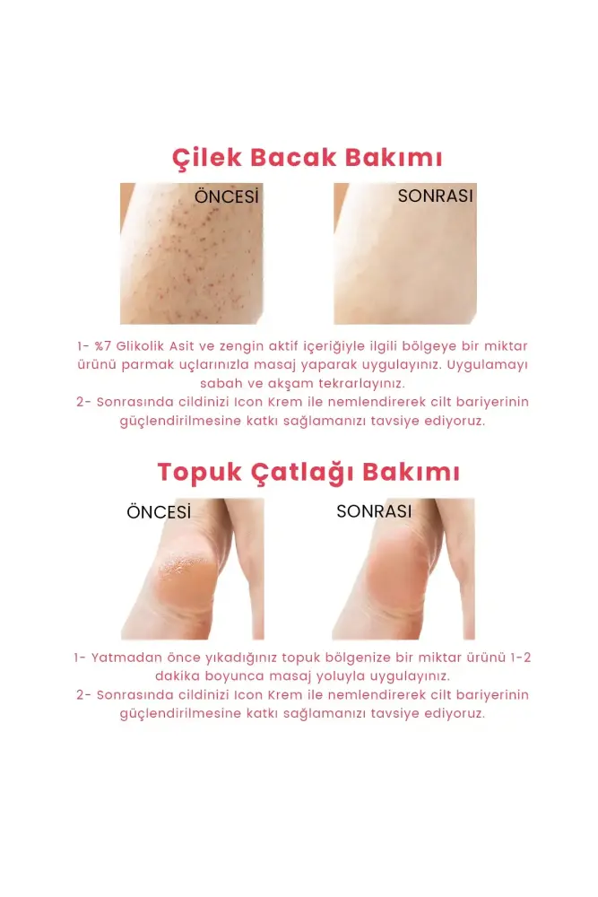 PROCSIN Hydro Solution Babypore Gözenek Sıkılaştırıcı ve Canlandırıcı %7 Glikolik Asit Ginseng Tonik 200ML - 2